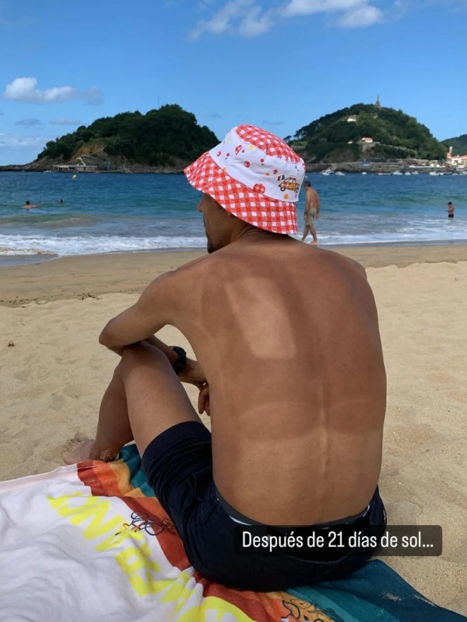 Daniel Felipe Martínez se muestra insolado